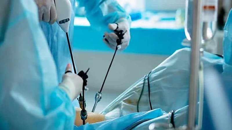 الذيابي يحسم الجدل بشأن إزالة الحصوات من المرارة بالمنظار دون استئصالها