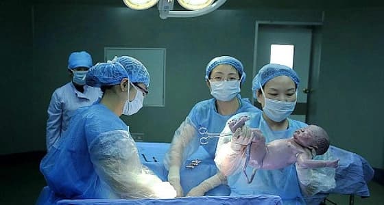 الصحة العالمية تكشف أسباب زيادة معدلات الولادة القيصرية