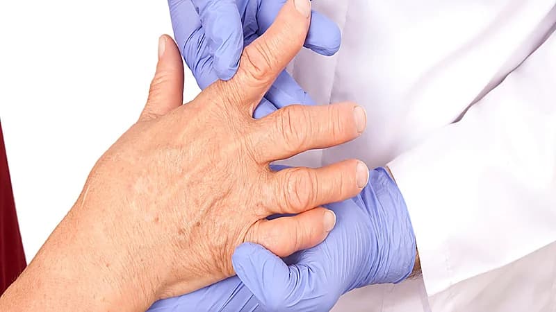 بالفيديو.. استشاري يوضح أعراض مرض الروماتويد وأكثر الفئات عرضة للإصابة به