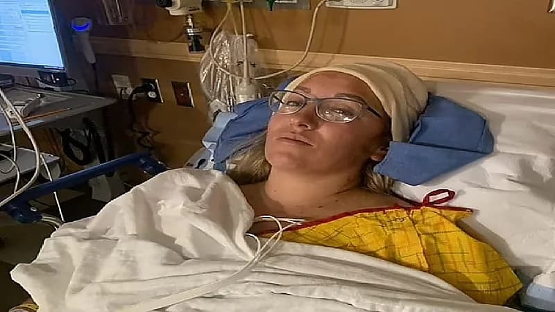 بالصور.. الجلوس في الشمس يتسبب في فقدان سيدة جزءا من رأسها