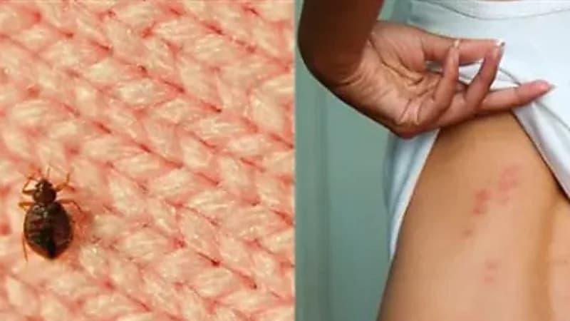 3 علامات تدل على وجود بق الفراش في المنزل