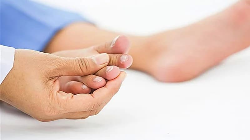 3 أعراض تظهر في القدمين قد تكون علامات تحذيرية لـ "القاتل الصامت "