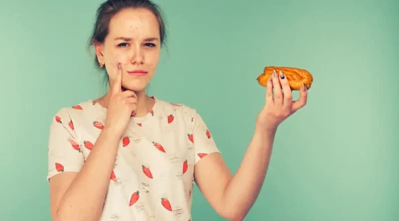 10 أطعمة تحمى بشرتك من ظهور حب الشباب