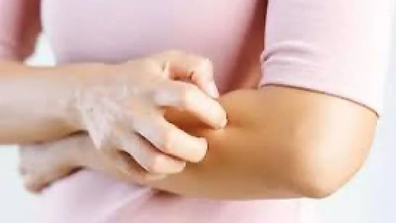 5 أمراض جلدية تنتشر في الخريف