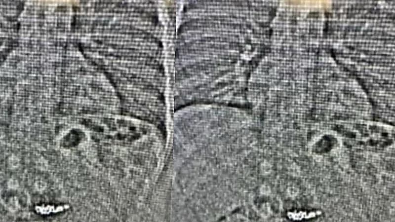 لص يبتلع أقراط ألماس بقيمة 770 ألف دولار