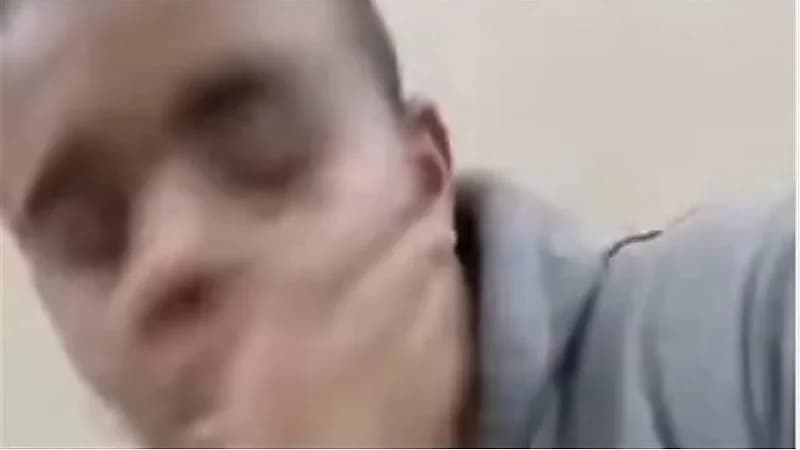 فتاة تصفع طبيب أسنان داخل عيادته