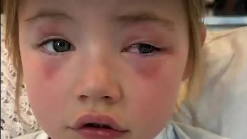 مسحوق غسيل يتسبب في فقد طفلة لبصرها