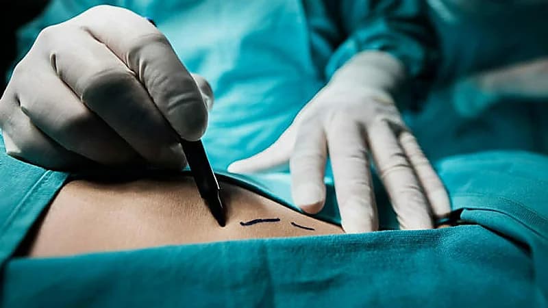 استئصال الرحم يزيد خطر الاصابة بالسكتة الدماغية