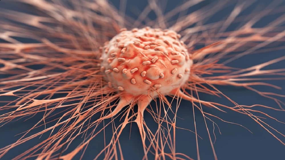 استشارية: التدخين وحده لا يكفي للوقاية وهذه طرق حماية الجسم من السرطان .. فيديو