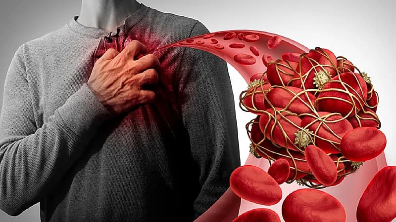 تحذير من دعاية مخادعة تدعي وجود إبر لفتح الشرايين المسدودة بالقلب