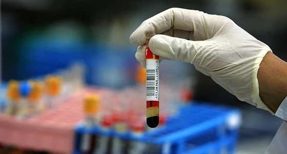 علاج جديد يعيد الحيض للمرأة بعد سن اليأس