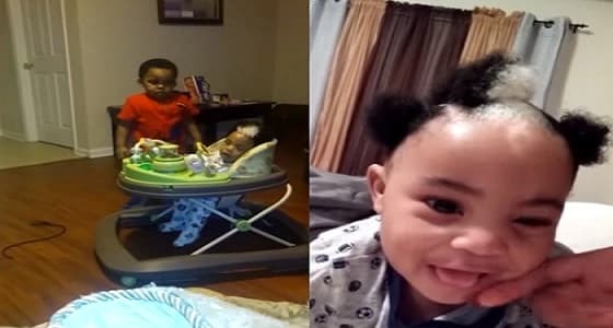 بالفيديو.. حالة نادرة لطفل ولد بشعر أبيض