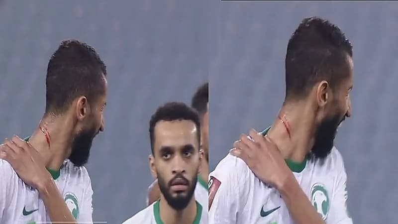 عبدالرحمن بن مساعد: حكم غريب إذا إصابة بدم ما فيها كرت!