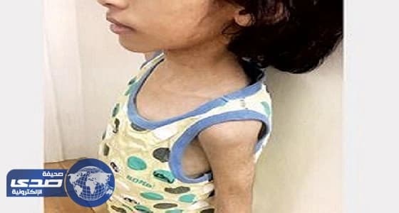 تفاصيل جديدة في واقعة الأطفال المعنفين بمكة