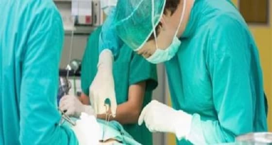 استخراج مقص طبي استقر 34 عاما في معدة مريض