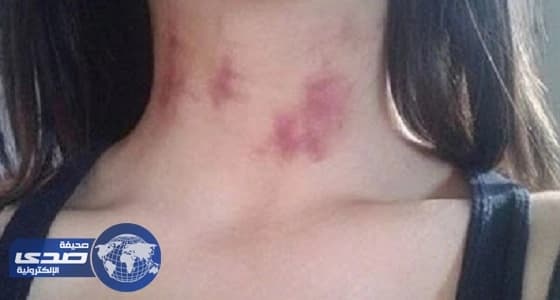 تعرفي على 4 حقائق عن البقع الحمراء بعد العلاقة الجنسية