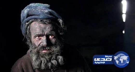 بالفيديو ..وفاة ستيني صاحب لقب أقذر رجل في أوروبا